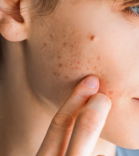 AURODHEA Unguento all'Ittiolo 9,8% 30ml - Cod. MD01B