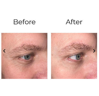 PEPTILUX Crema contorno occhi antirughe 'effetto shock action' con LIPHASYN™ 20ml - Cod. LUX001