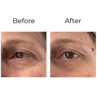 PEPTILUX Crema contorno occhi antirughe 'effetto shock action' con LIPHASYN™ 20ml - Cod. LUX001