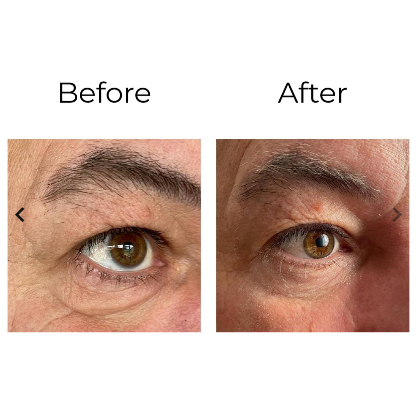 PEPTILUX Crema contorno occhi antirughe 'effetto shock action' con LIPHASYN™ 20ml - Cod. LUX001